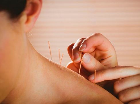 Agulhas de acupuntura da medicina tradicional chinesa
